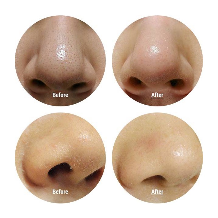 THE FACE SHOP  Dung Dịch Tẩy Tế Bào Chết Đường Đen Mật Ong Thông Minh 120ml