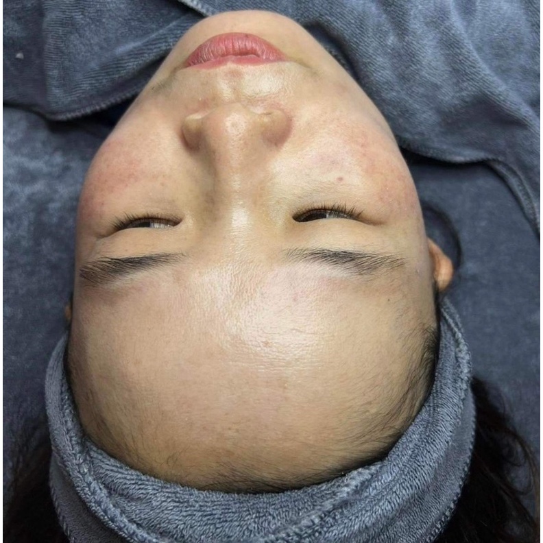Kem Dưỡng Da Perfect Melasma Mờ Thâm, Nám, Sạm, Tàn Nhang, Dưỡng Trắng Da Hiệu Quả