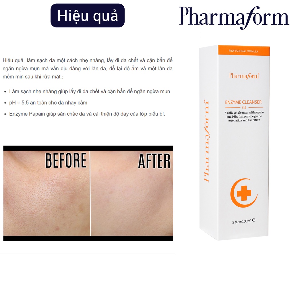 Sữa rửa mặt GEL tẩy tế bào chết, làm sạch bụi bẩn và cấp ẩm cho da Pharmaform Enzyme Cleanser Gel 150ml