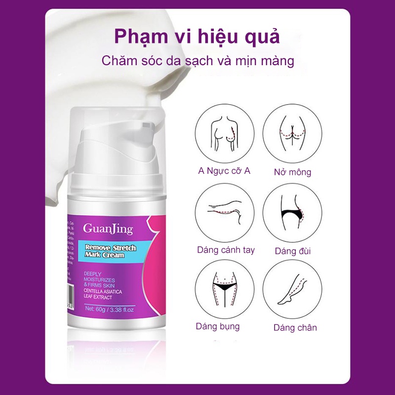 Kem rạn da (Xóa rạn da nhanh chóng trong 7 ngày)Kem xoá rạn da sau sinh làm mờ vết thâm tăng độ đàn hồi cho da làm trắng | BigBuy360 - bigbuy360.vn