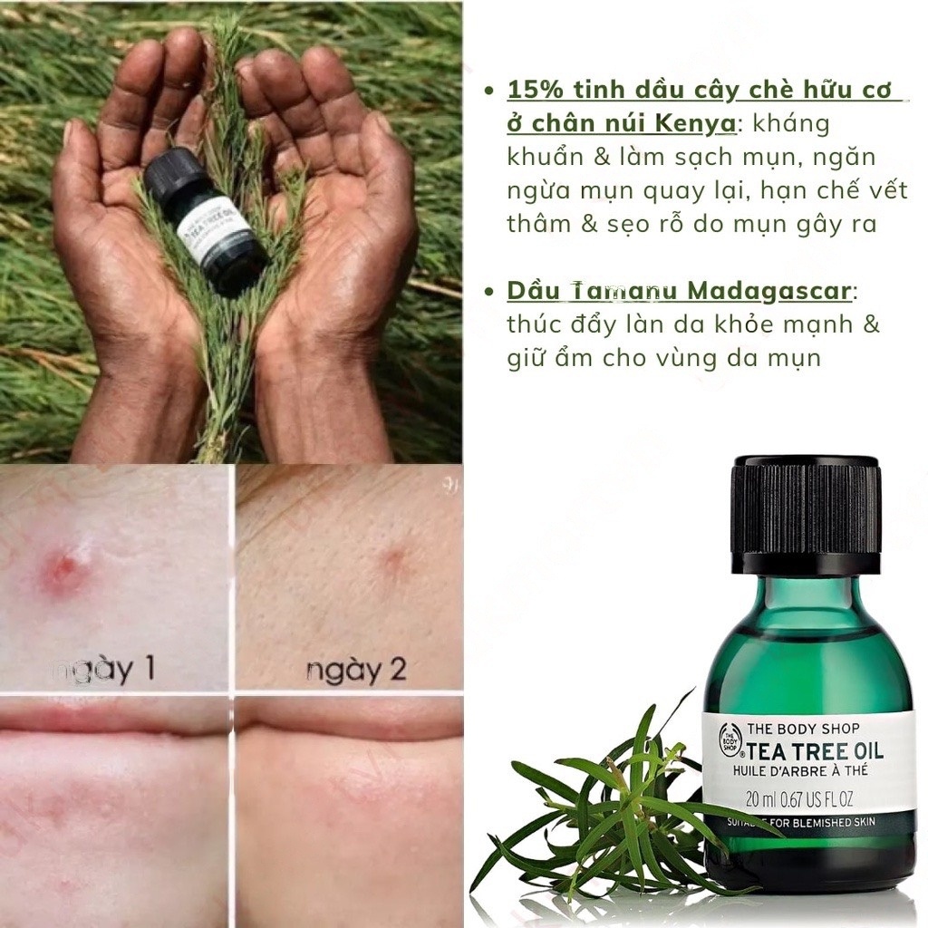 Tinh Dầu Chấm Mụn Tea Tree Oil, Giảm Mụn, Mờ Thâm The Body Shop