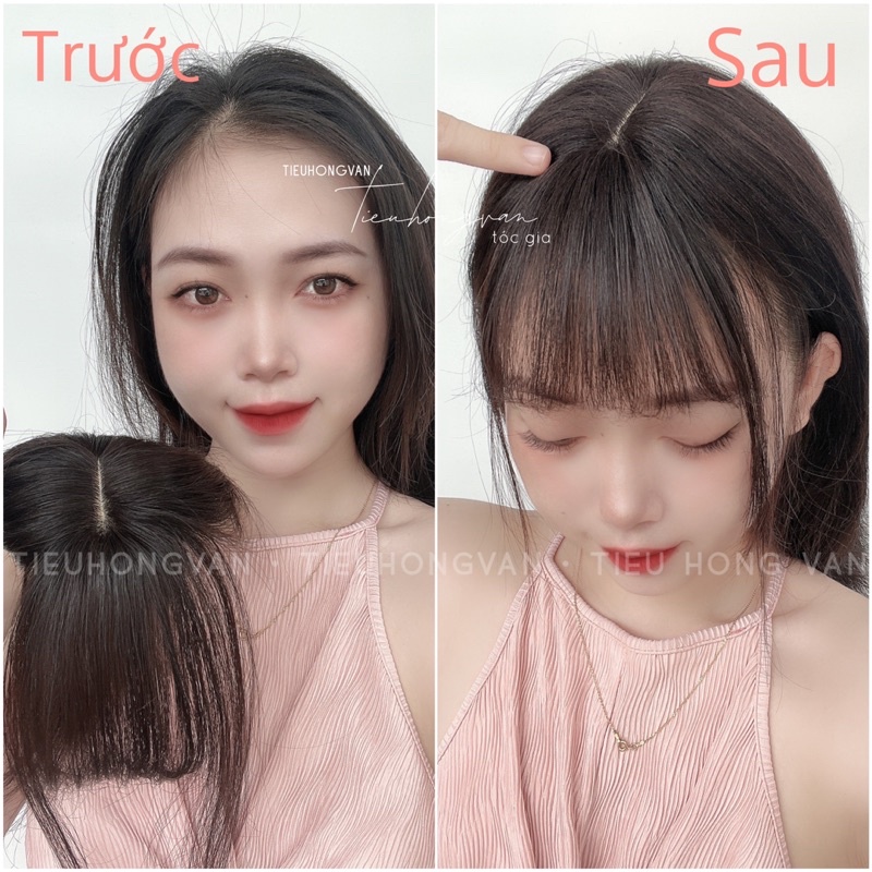 MÁI PHỦ HÓI 4D da đầu Silicone - Tóc Thật
