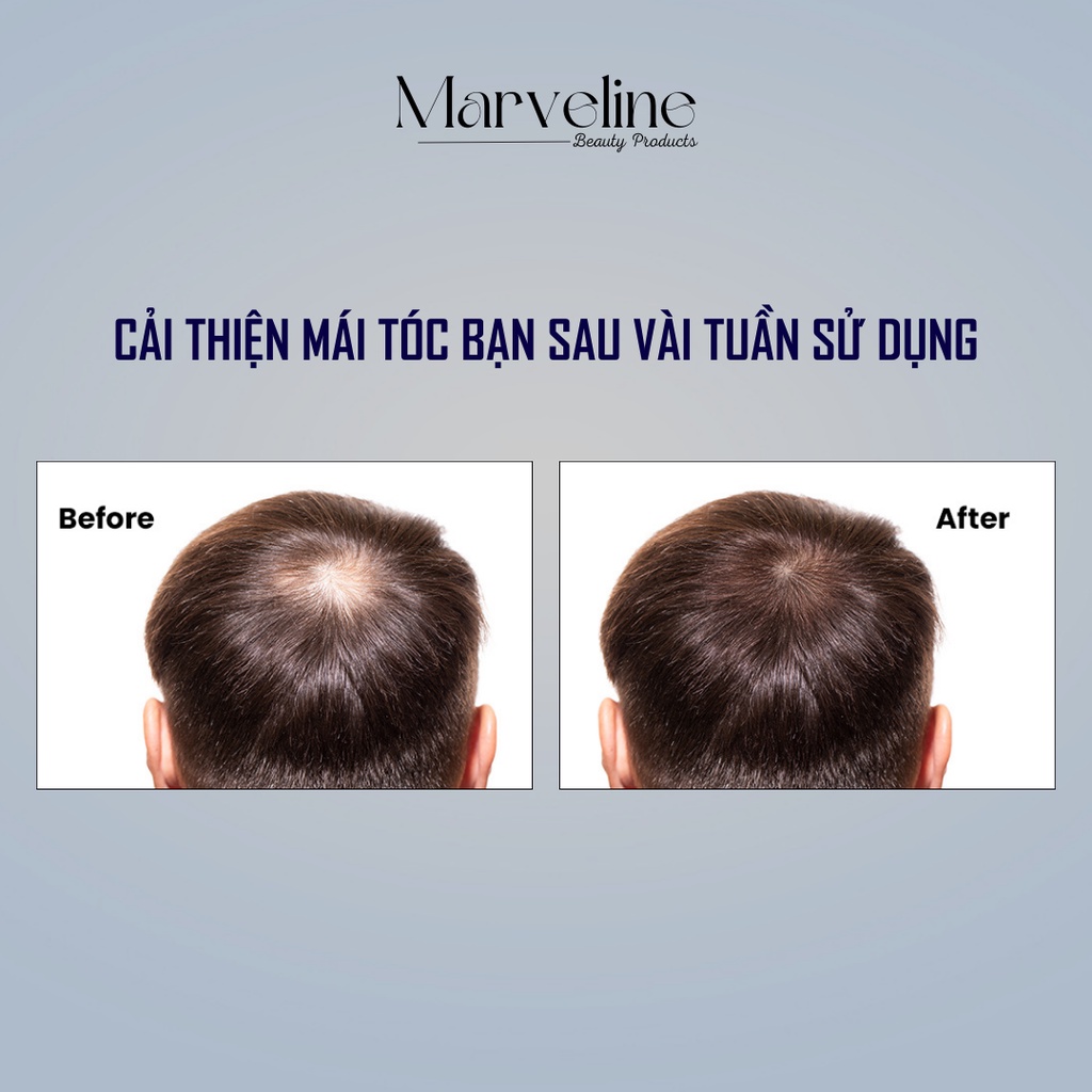 Tinh chất kích mọc tóc, ngăn rụng tóc cho Nhật Bản Kaminomoto Hair Growth Accelerator