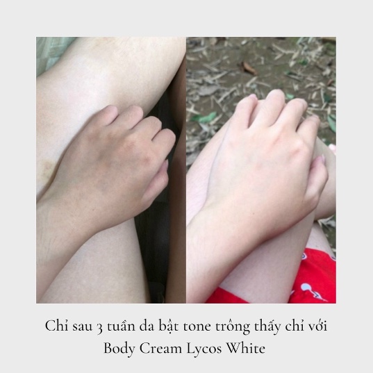 Kem Body Cốt Men Rươ.u Lycos White