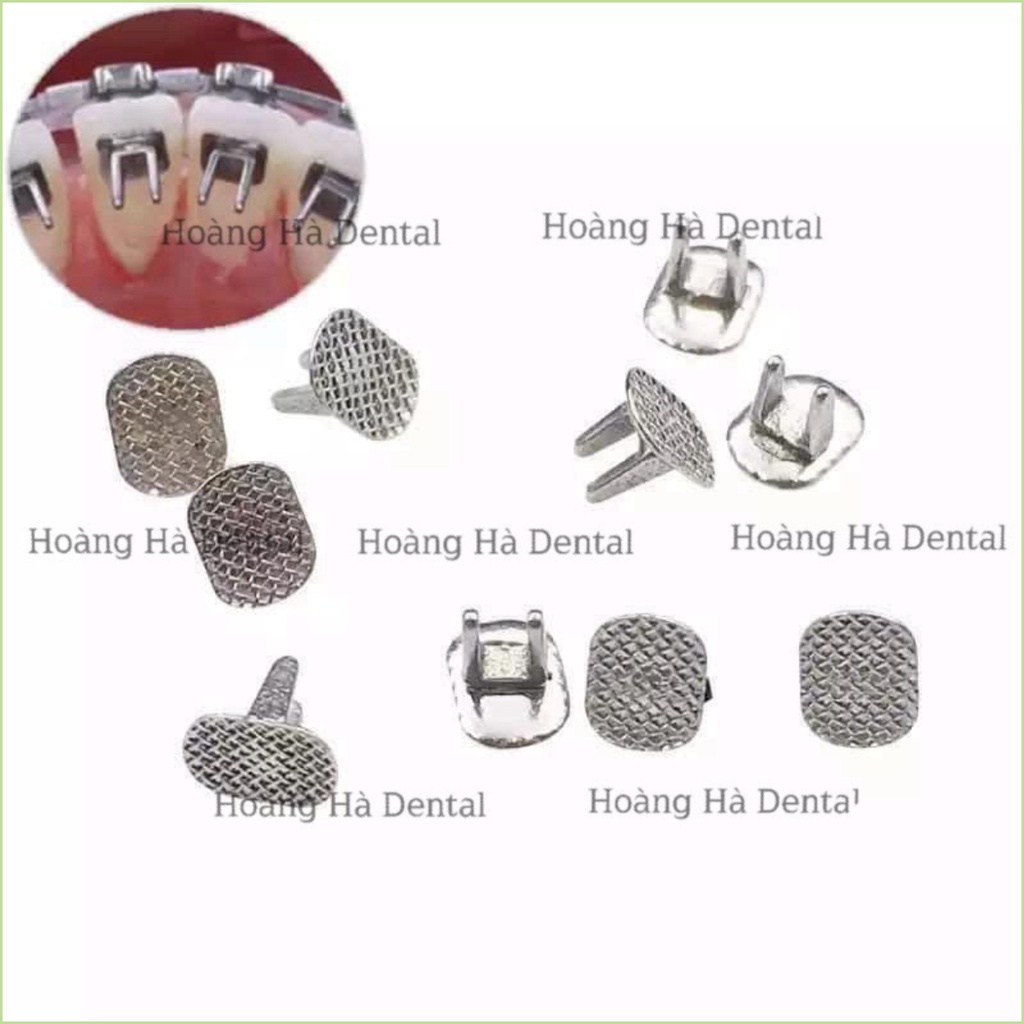 10 Nút dán chặn đẩy lưỡi chỉnh nha - NHA KHOA HÀ NỘI