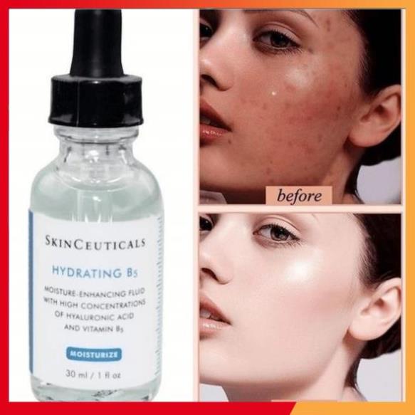 Serum skinceuticals HYDRATING B5 GEL cấp nước cấp ẩm phục hồi da siêu đỉnh bản Mỹ 30ml -Linh68beauty