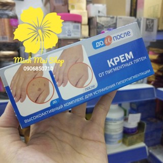 Kem đồi mồi tay chân Kpem Nga - Kem xóa mờ đồi mồi đốm nâu tàn nhang 50g