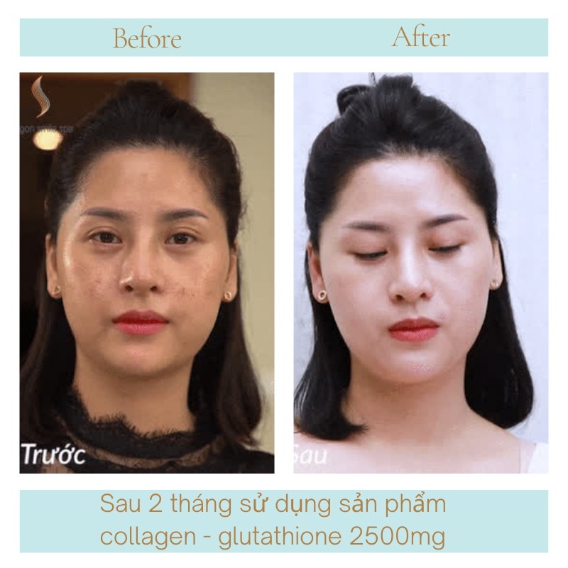 Trắng da COLAGEN -GLUTATHIONE 2500MG viên uống nâng tone cấp tốc đẹp da giảm nám tàn nhang tăng nội tiết | BigBuy360 - bigbuy360.vn