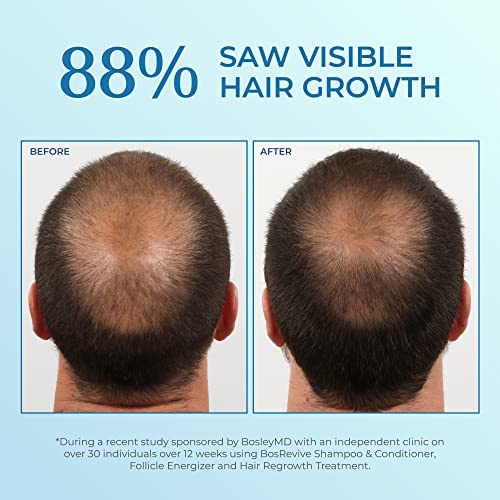 Foam Giúp mọc tóc Nam Rogaine 5% Minoxidil Topical Aerosol Hair Regrowth Treatment chính hãng Mỹ