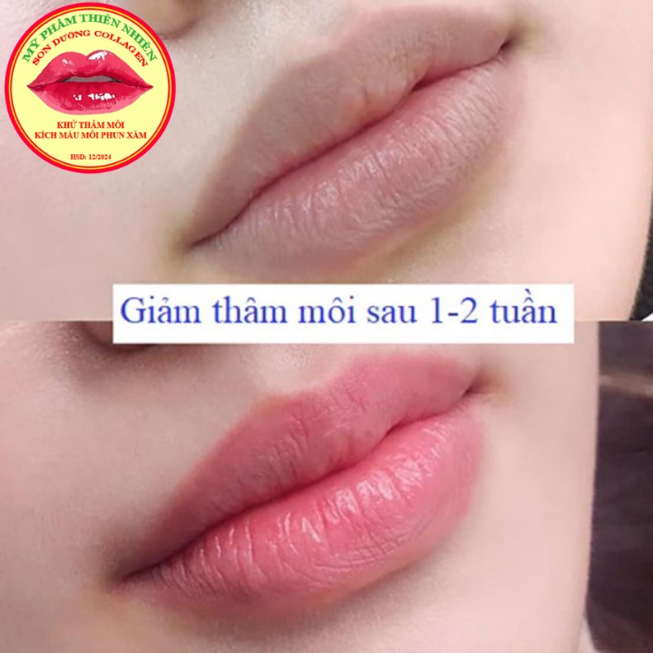 Son Dưỡng Môi Collagen Giảm Thâm, Kích Màu Môi Sau Phun Xăm, Dưỡng Môi Căng Bóng, Mềm Mượt