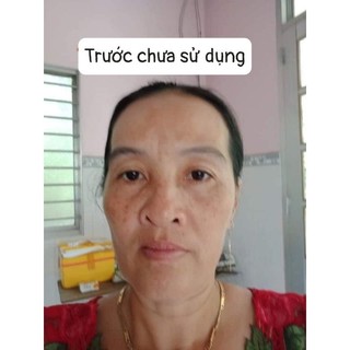 Kem dưỡng cấy trắng da ( tặng kèm serum ).
