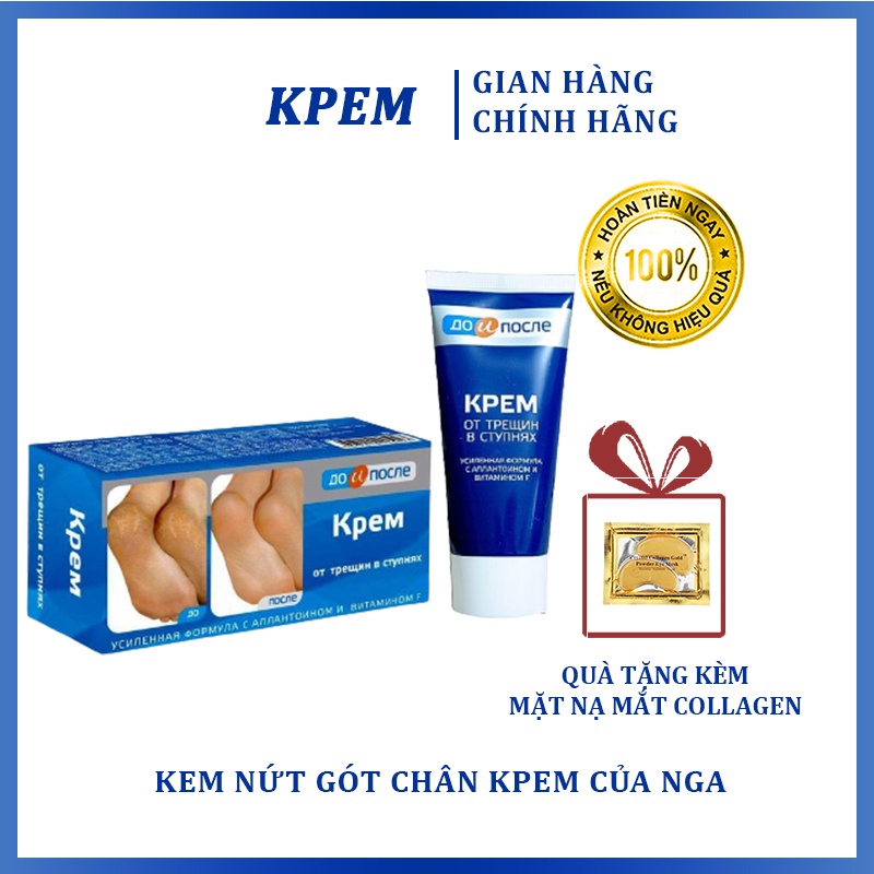 Kem Giảm Nứt Gót Chân Kpem Apteka Nga 50ml - Hỗ Trợ Cải Thiện Nứt Gót Chân, Cho Da Bàn Chân Mềm Mịn Khỏe Mạnh
