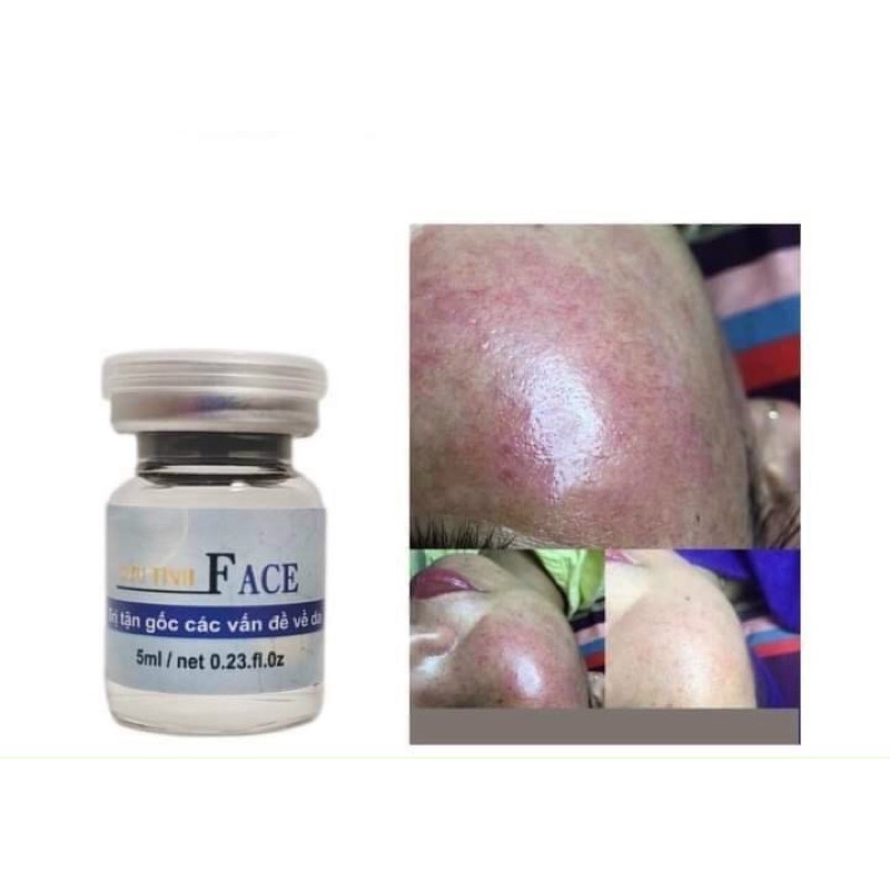 Cứu tinh face 10ml phục hồi da đỏ yếu