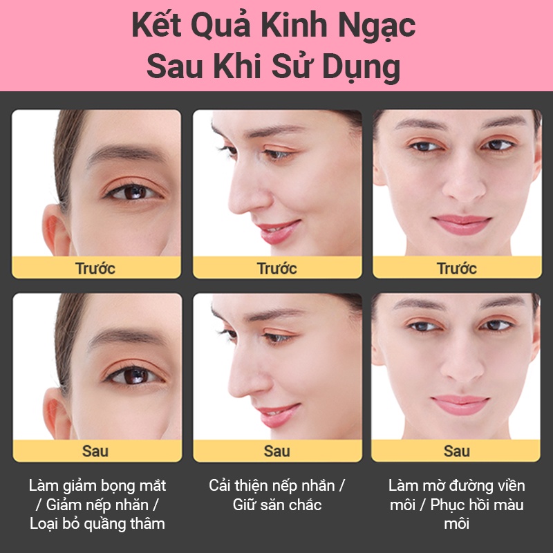 Máy Mát Xa Mặt inFace MS5000 Thiết Kế Công Thái Học Với 3 Chế Độ Khác Nhau Tần Số Rung Cao Hiệu Quả Cao