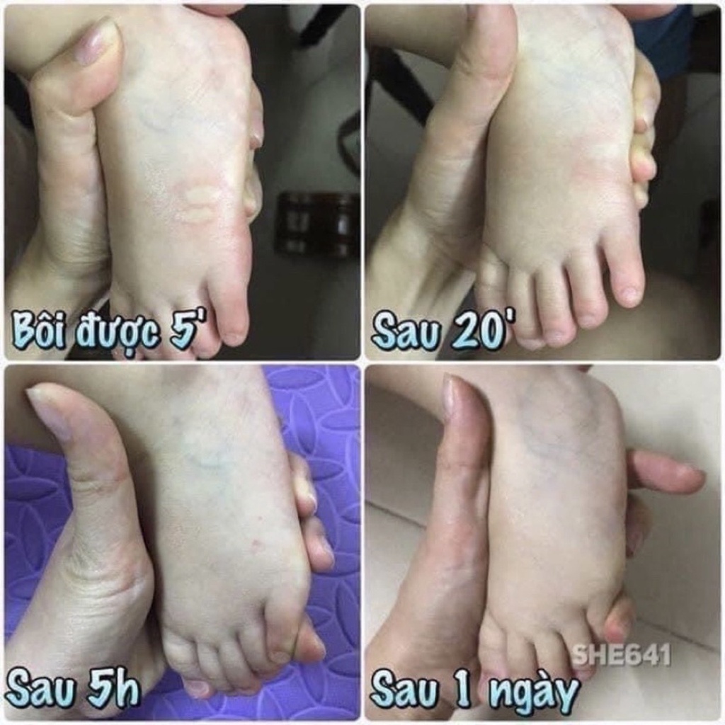 Dầu Cù Là Muỗi Sả Thái Lan Chống Muỗi Đốt Côn Trùng Cắn 20g