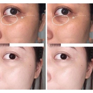 KEM MẮT ỐC SÊN CHASKIN HÀN QUỐC 40ML