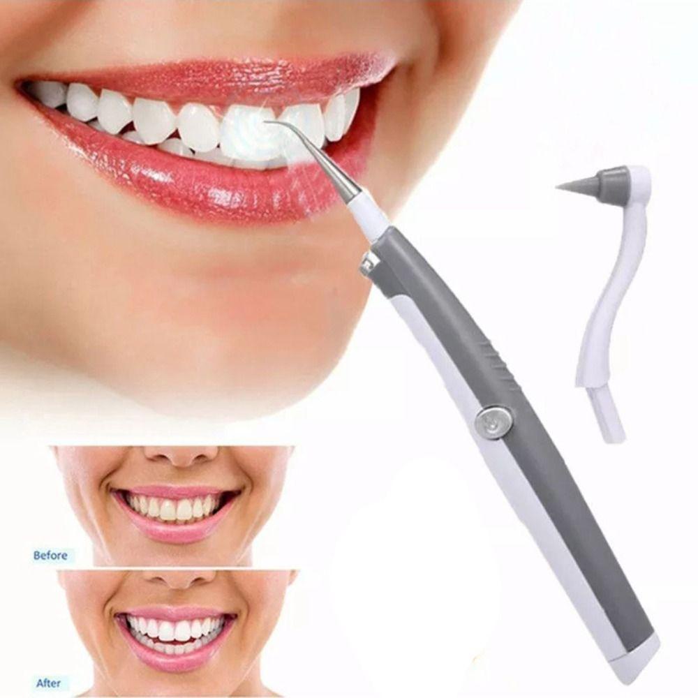 Jane Máy Cạo Vết Bẩn Làm Trắng Răng Sử Dụng Sóng Âm