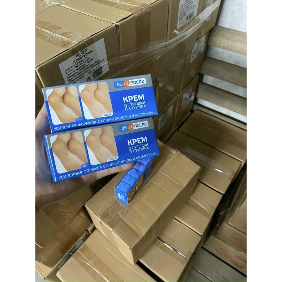 Kem Hồi Phục Nứt Nẻ Gót Chân Kpem Hàng Nga Chính Hãng