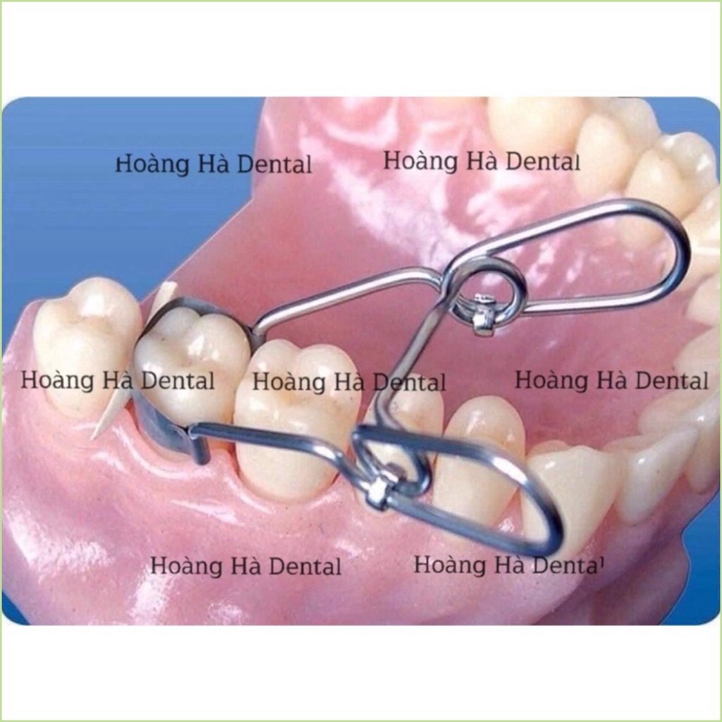 Bộ khuôn trám matrix, bộ khuôn trám răng - NHA KHOA HÀ NỘI