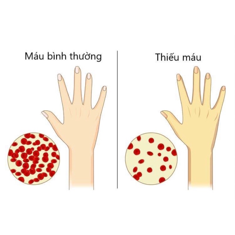 Viên uống bổ sung Sắt Sanotact Eisen Đức
