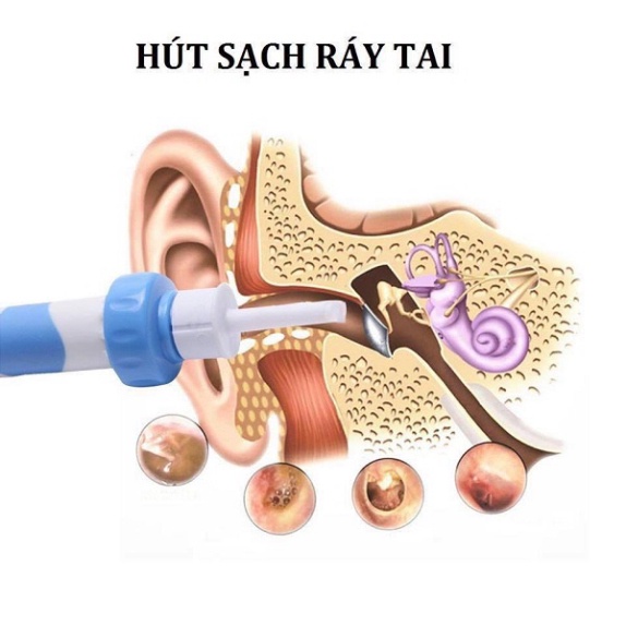 Máy Hút Ráy Tai Nhật Bản Cho Bé - Dụng Cụ Lấy Ráy Tai Tại Nhà Tự Động An Toàn Tuyệt Đối Khi Sử Dụng
