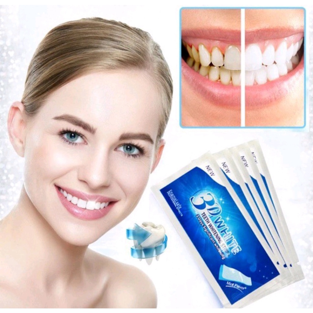 Miếng dán làm trắng răng 3d tiện dụng