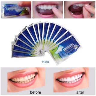 Miếng dán làm trắng răng 3d tiện dụng