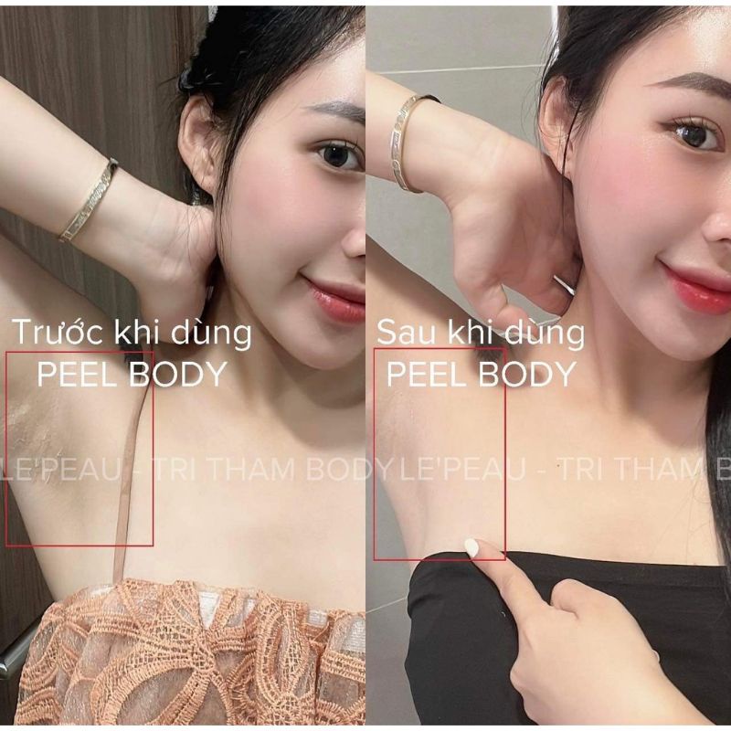 Peel Da Vi Tảo Sinh Học, Peel Nách Body Tái Tạo Da Toàn Thân Thay Da Sinh Học Giúp Dưỡng Ẩm Kích Trắng Mờ Thâm - LE PEAU | BigBuy360 - bigbuy360.vn