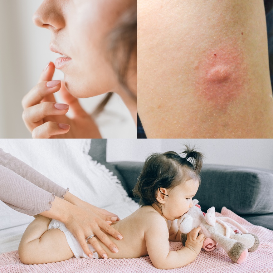 SÁP THẢO MỘC chiết xuất Calendula & St.John's Wort từ LANCHANS