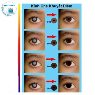 Kính áp tròng thẩm mỹ- Che tật thị- Mua lens tặng chai ngâm lens Qeye 140ml