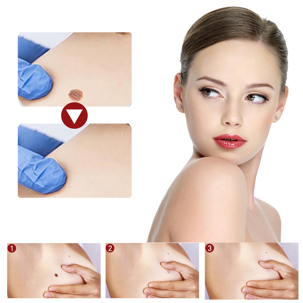 Lột mụn cóc, tẩy nốt ruồi, làm loãng hắc tố, xóa vết thâm, dưỡng trắng và dưỡng ẩm tinh chất vitamin E 20ml