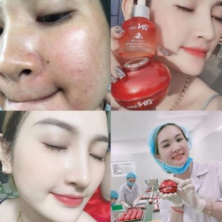 Serum collagen bn white