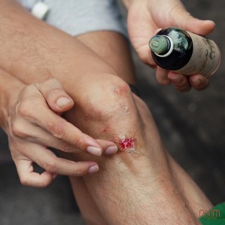 Dầu mù u ép lạnh Noom 10ml