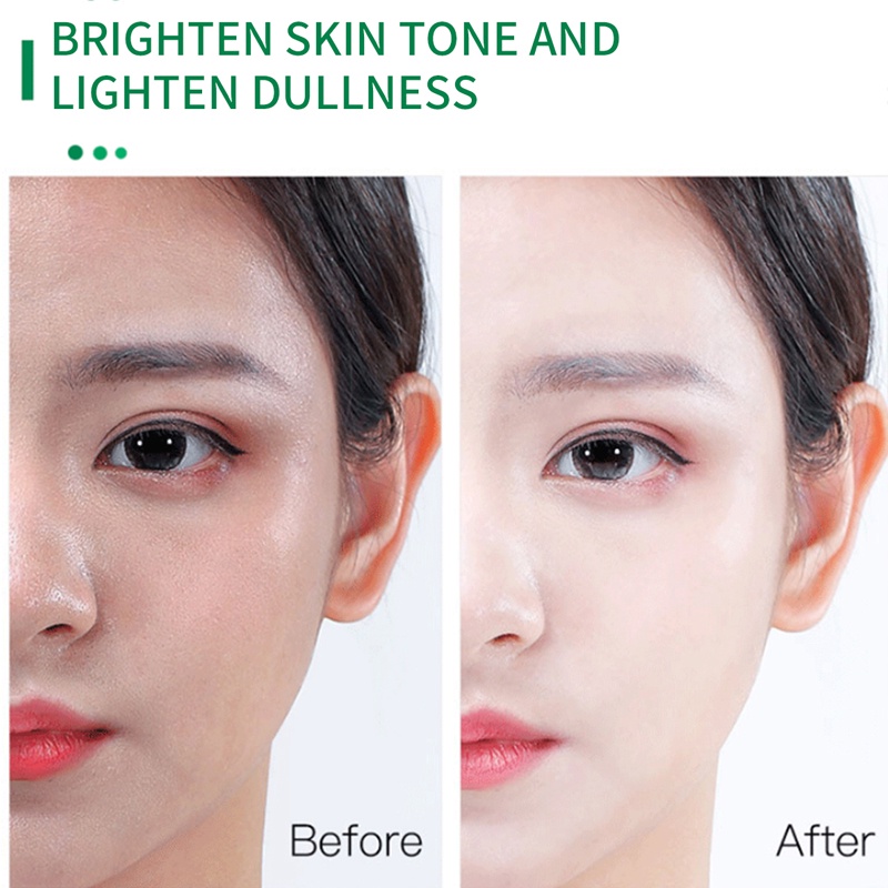 Tinh Chất Vitamin E BEDIVAR Làm Trắng Da Loại Bỏ Các Đốm Đen Và Làm Mịn Da