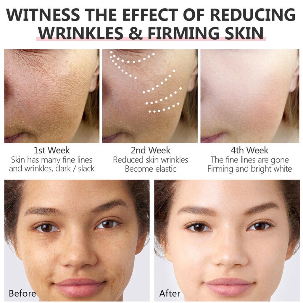 Serum 2.5% Retinol Chống Lão Hóa Dưỡng Ẩm Nâng Cơ X4P2