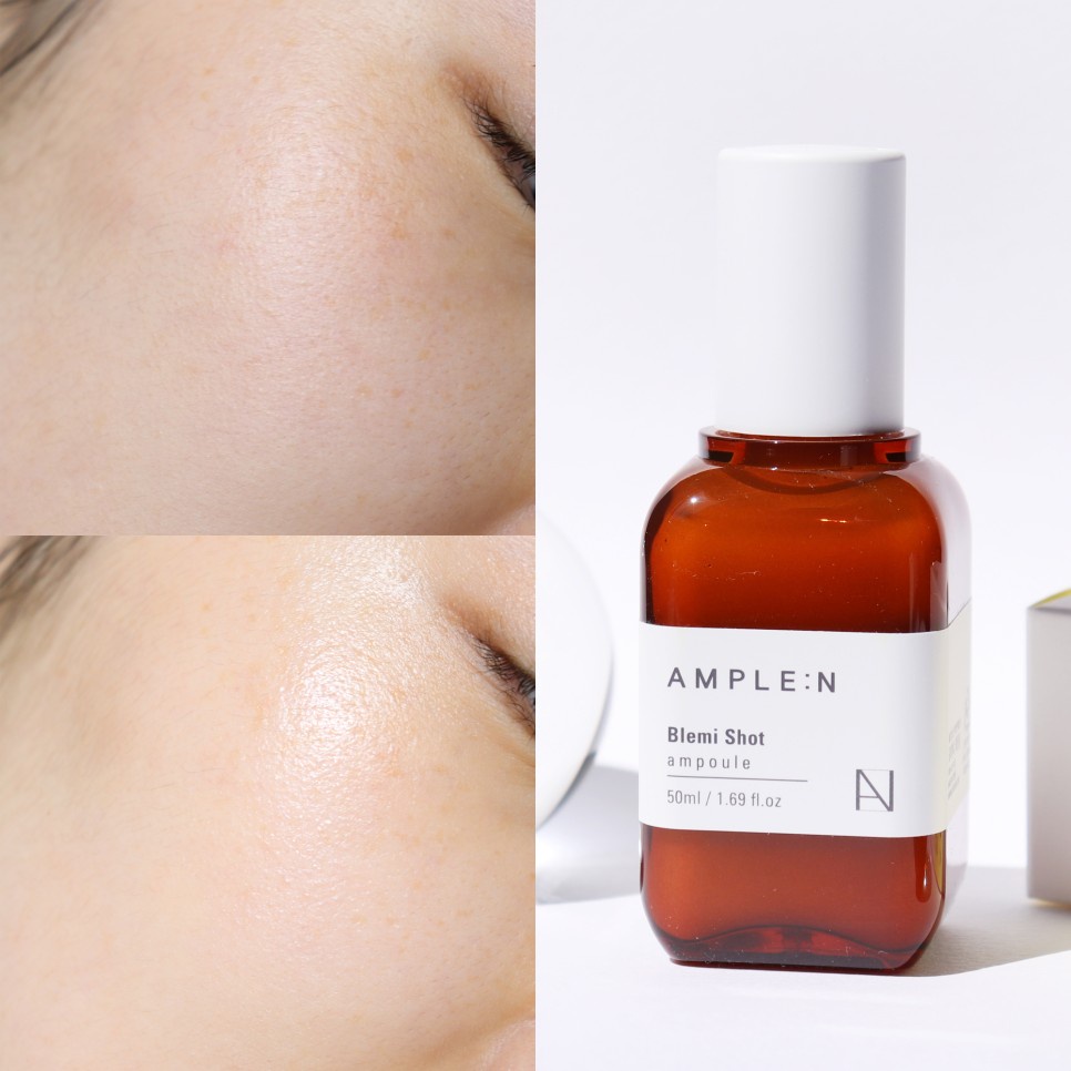 Tinh chất sáng da mờ thâm nám Ample:N Blemi Shot Ampoule 50ml