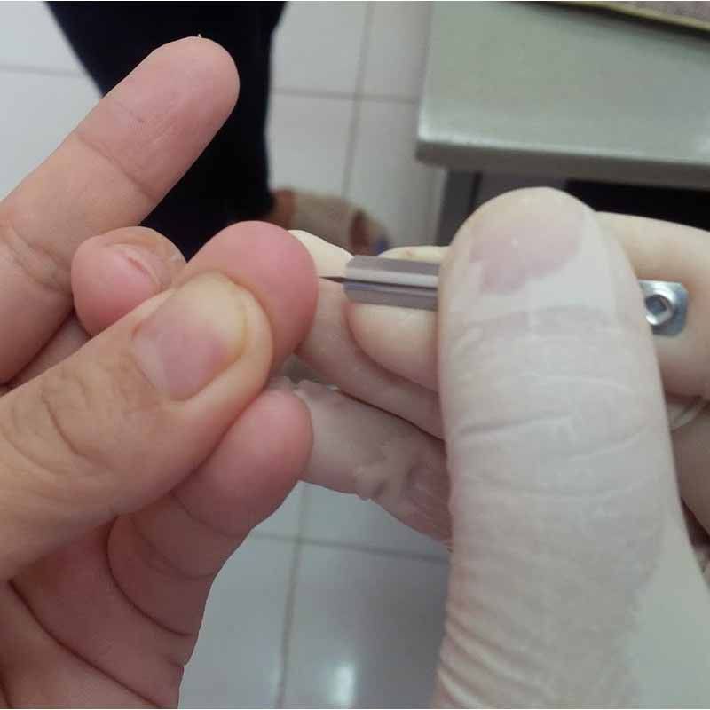 Kim chích mụn Hộp 200 kim