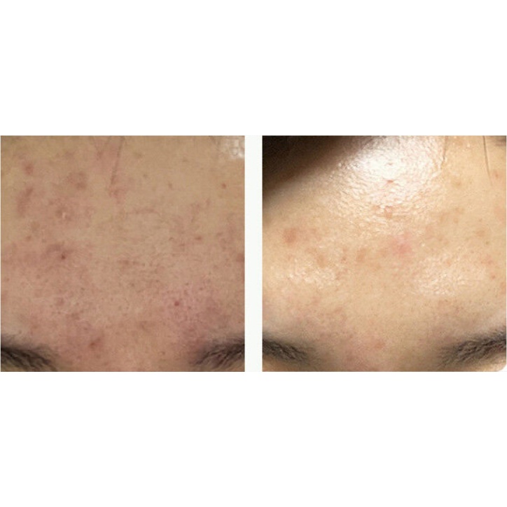 Bộ Serum Đặc Biệt Nosca 9 Trouble