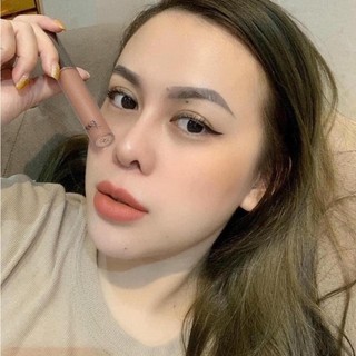 Gel Mụn Trứng cá Megaduo 15g