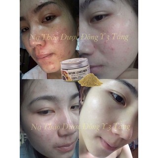 MẶT NẠ THẢO DƯỢC 3 TẦNG