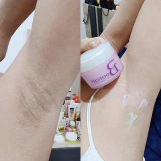 Kem tẩy thâm đen nách, mông, rạn da Bootchy White Thái Lan