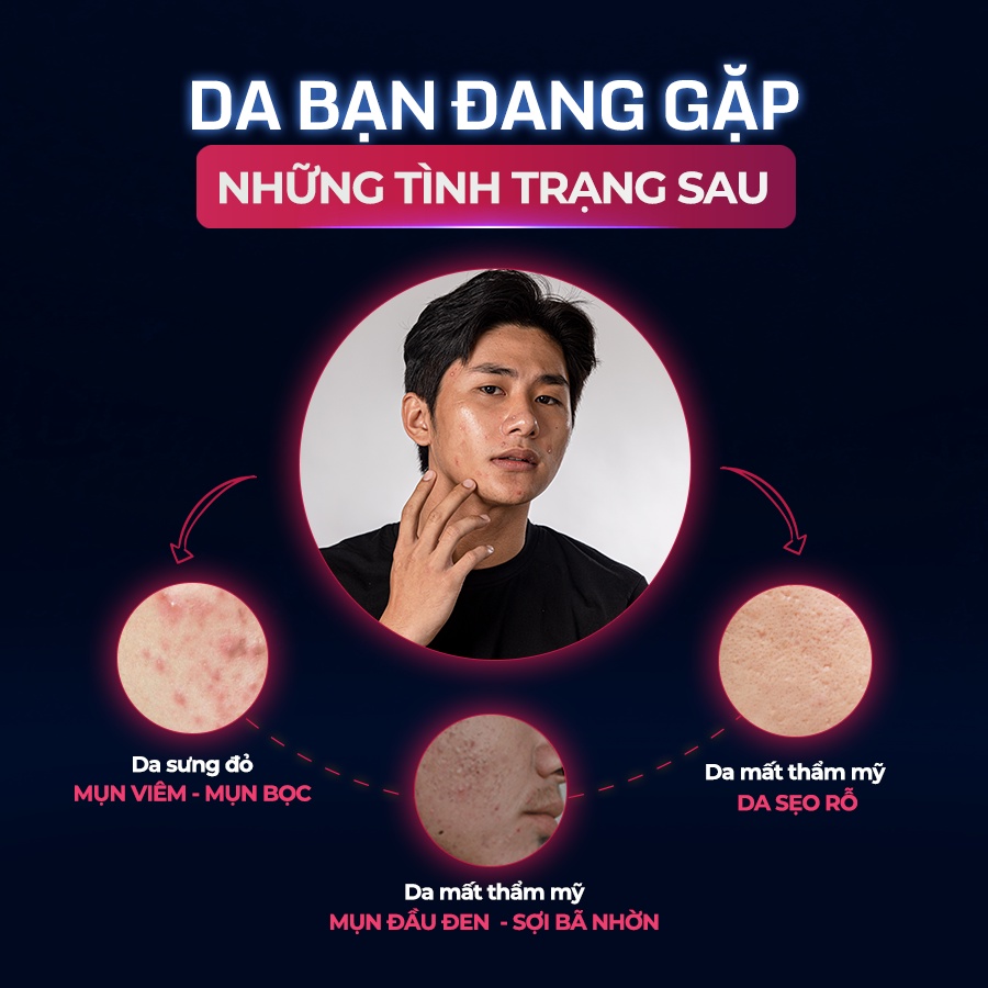 Tinh Chất Chấm Mụn Giúp Làm Khô Nhân Mụn,Làm Xẹp Mụn Viêm, Trứng Cá Và Mụn Đầu Đen The Menco Zinc White Acne 10ml