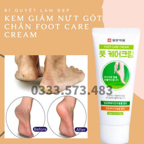 Kem nẻ gót chân yougreen F oint 60g Hàn Quốc Chính Hãng / Kem dưỡng và giảm nứt gót chân Foot Care Cream