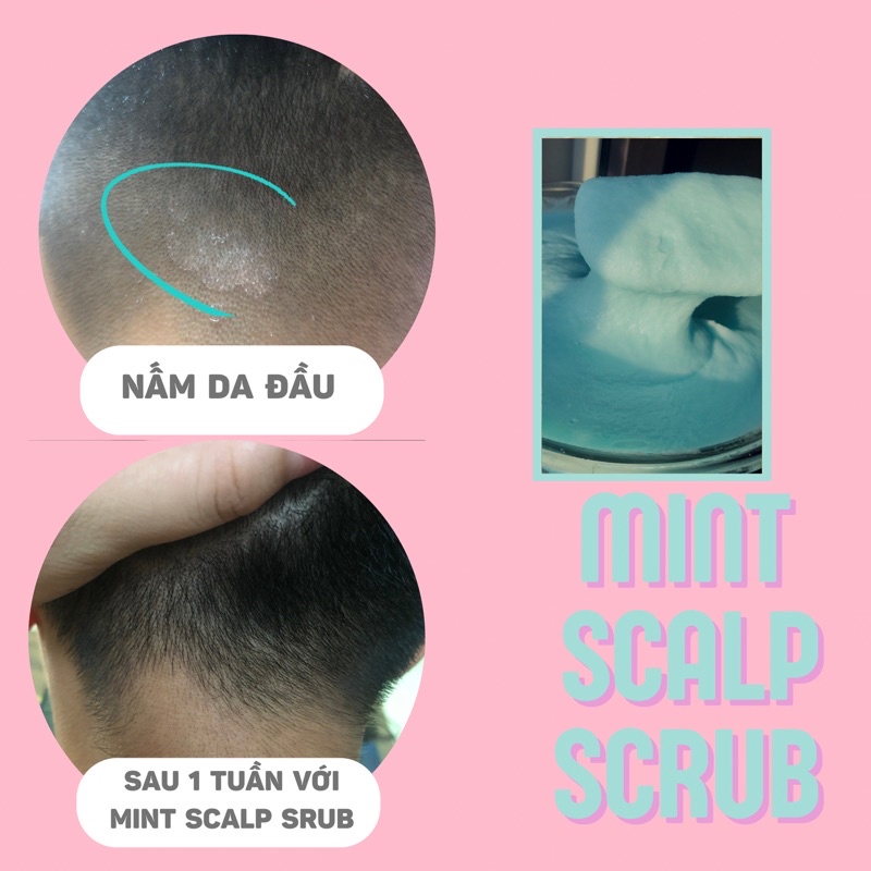 Tẩy tế bào chết da đầu Mint Scalp Scrub 300g | KATIEBEAUTY