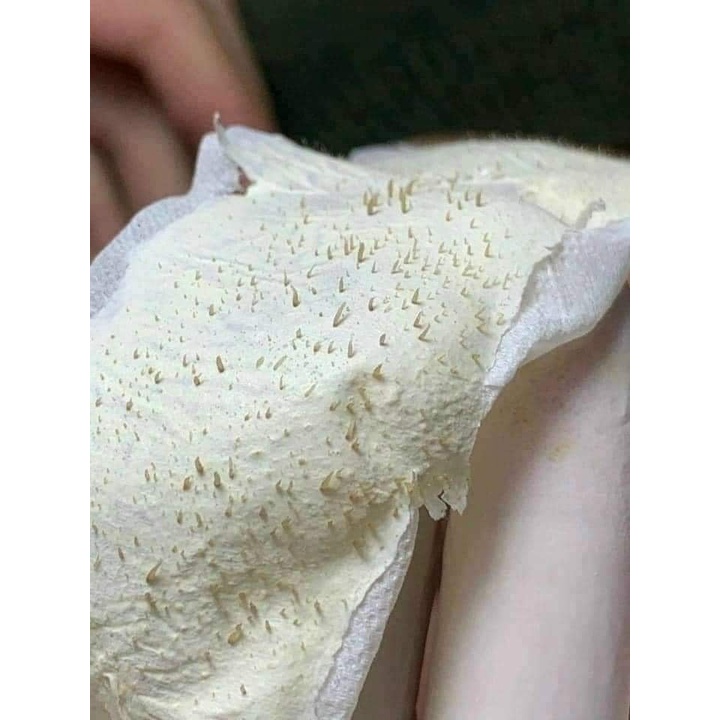 GEL LỘT MỤN THÁI LAN