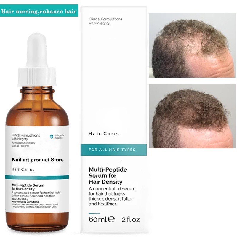 The Ordinary Serum dưỡng tóc, kích thích mọc tóc - The Ordinary Multi-Peptide Serum for Hair Density