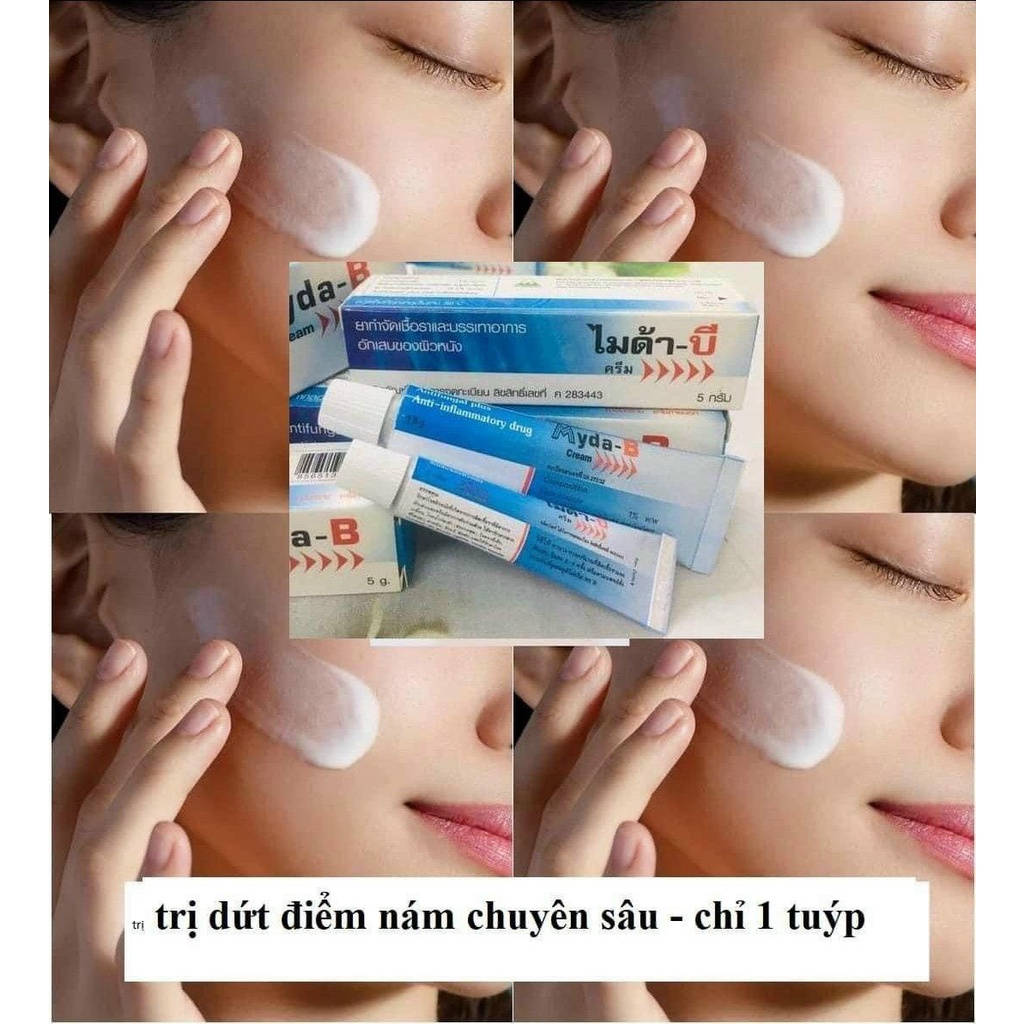 Kem  nám Myda- B thái lan chính hãng ( đủ size)