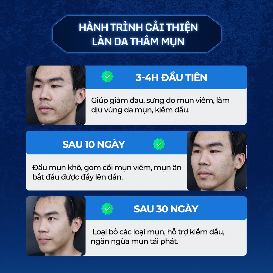 Tinh Chất Chấm Mụn Giúp Làm Khô Nhân Mụn,Làm Xẹp Mụn Viêm, Trứng Cá Và Mụn Đầu Đen The Menco Zinc White Acne 10ml