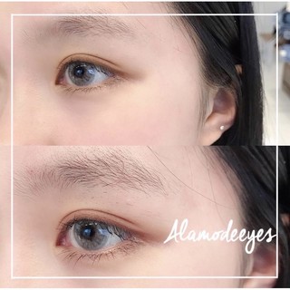 LENS xám đục K VÂN GIÃN NHẸ