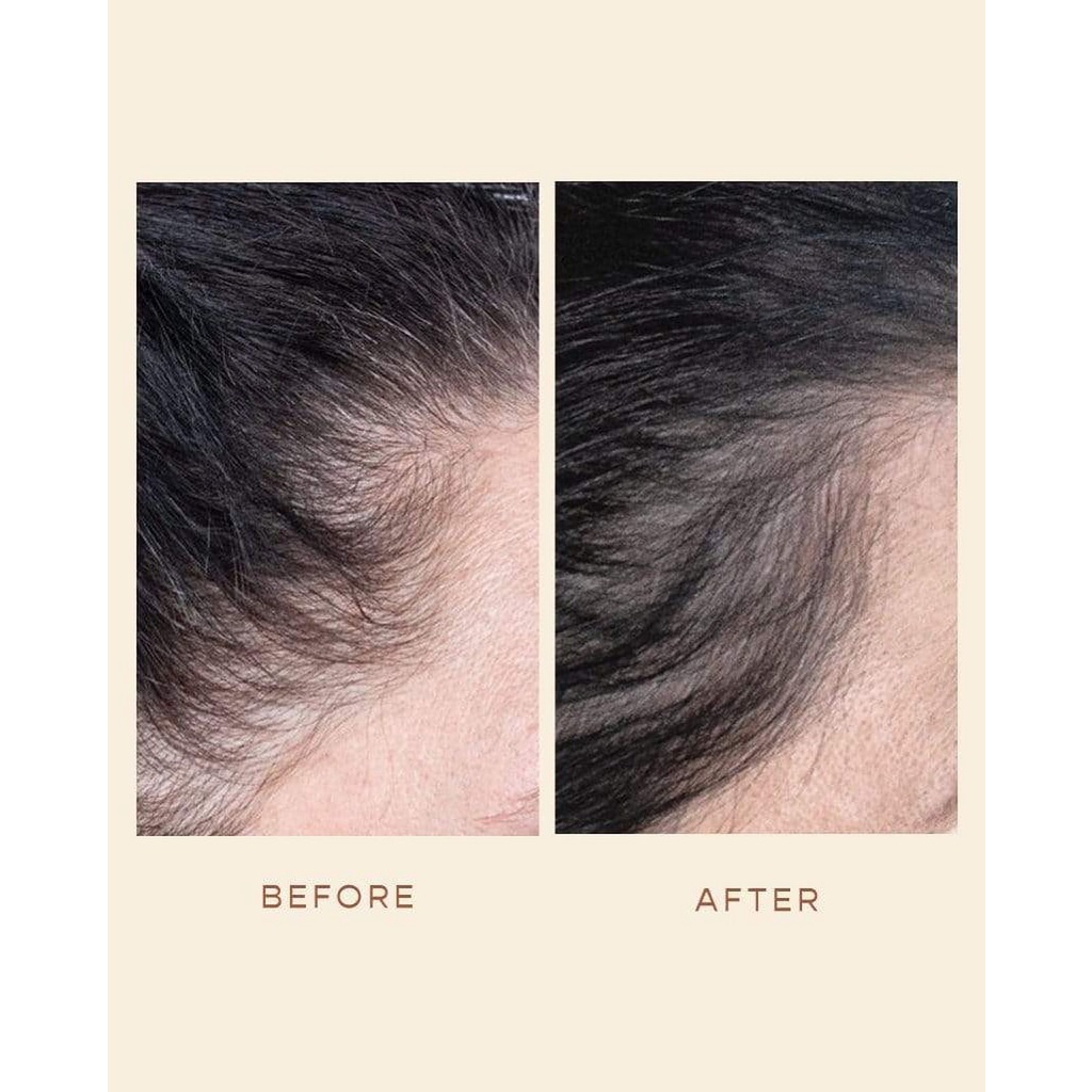 Serum, Gội - Xả kích thích mọc tóc Vegamour